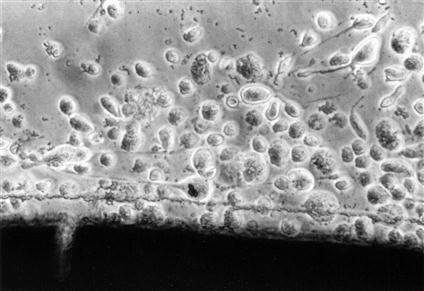 Cytotoxicita nosiče II Kontaktní cytotoxicita vložení testovaného materiálu do kultivační jamky s