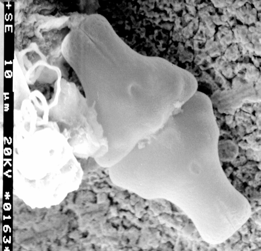 1a 1b 2 3 Figure 5: 1a, b Cosmarium