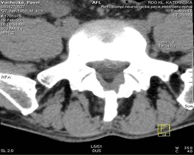 MRI