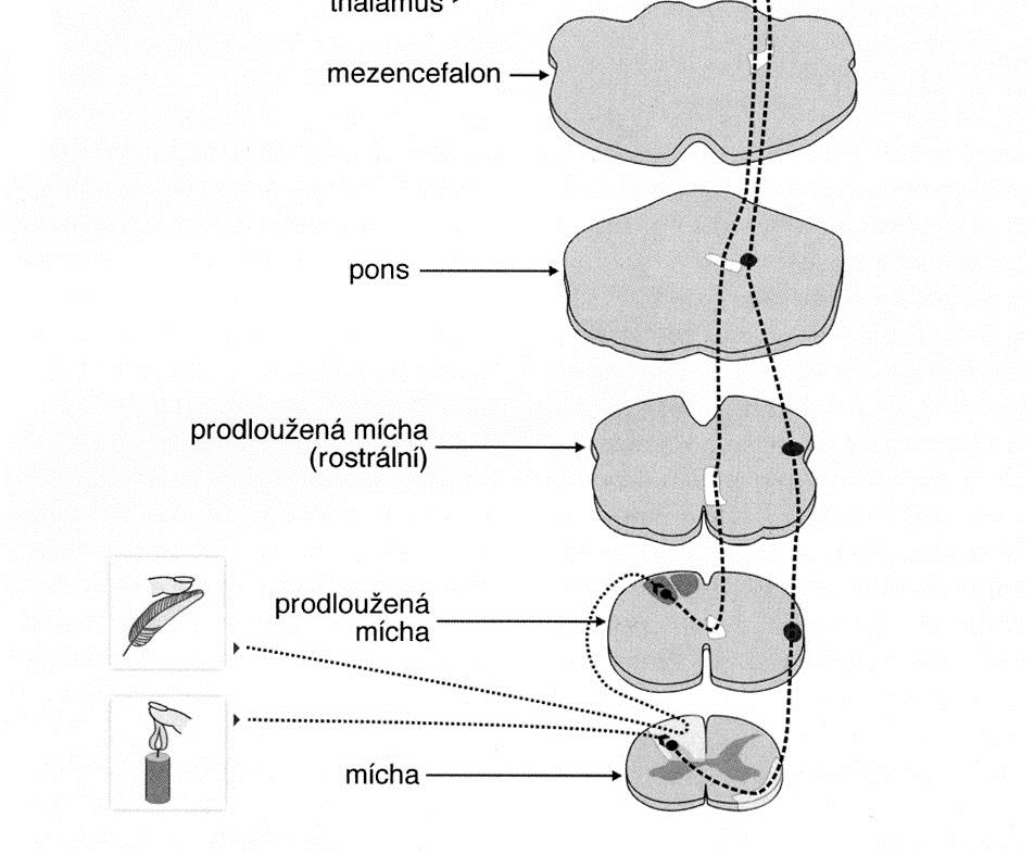Diagram of