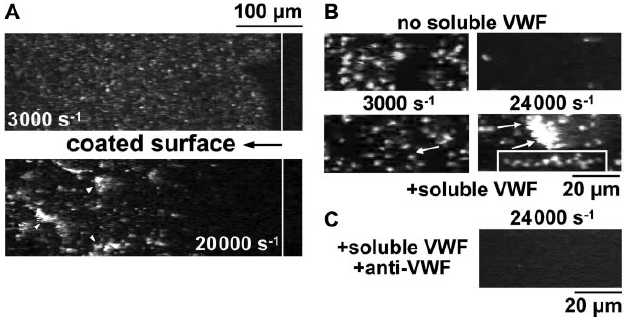 VWF a agregace trombocytů nezávislá na jejich aktivaci imobilizovaný VWF + inhibitor aktivace