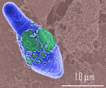 Clostridium botulinum Původce botulismu AG: 4 Ag skupiny toxinu A-G a) proteolytická ABF kmeny b)