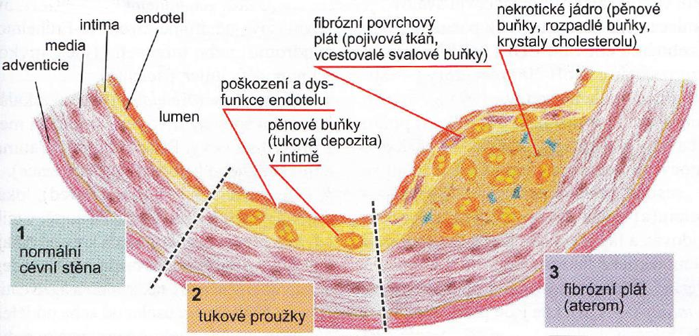 zejména monocytů a lymfocytů.