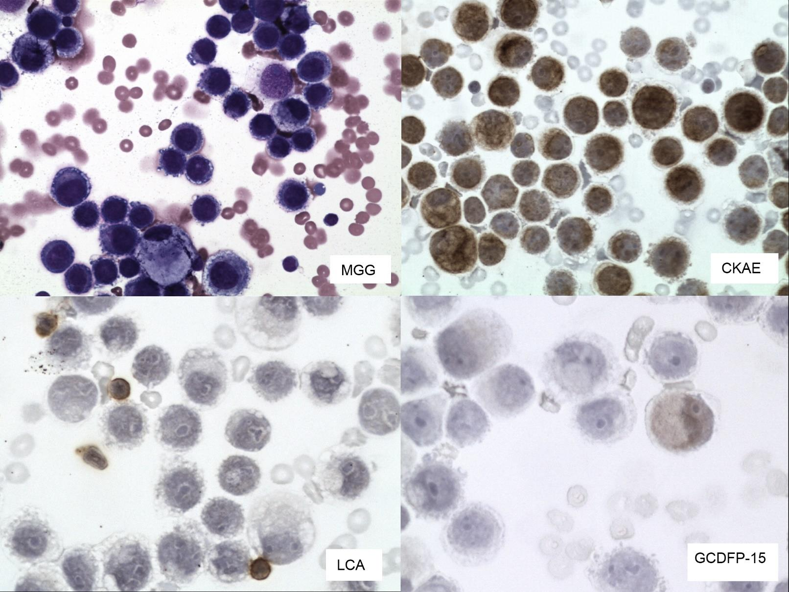 Imunocytochemická