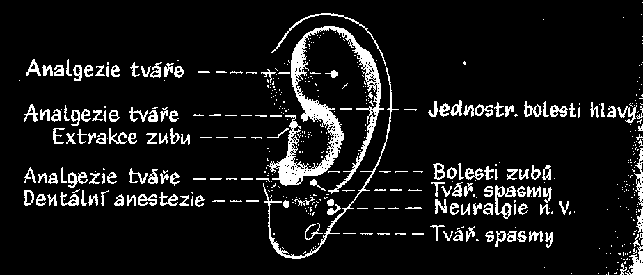K analgetickému působení se vyuţívají především body, které mají nějaký vztah k orofaciální oblasti, zejména z dráhy tlustého střeva, ţaludku a tenkého střeva.