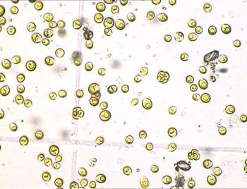 Fytoplankton s dominancí nano- a pikoplanktonu Malé řasy, rychlý růst a množení, odolávání žracímu tlaku, hydraulickým podmínkám a teplotě Z směs pikoplanktonu sinic a zelených řas, abundance u