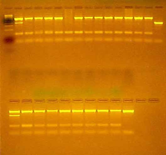 Vizualizácia výsledkov PCR C.