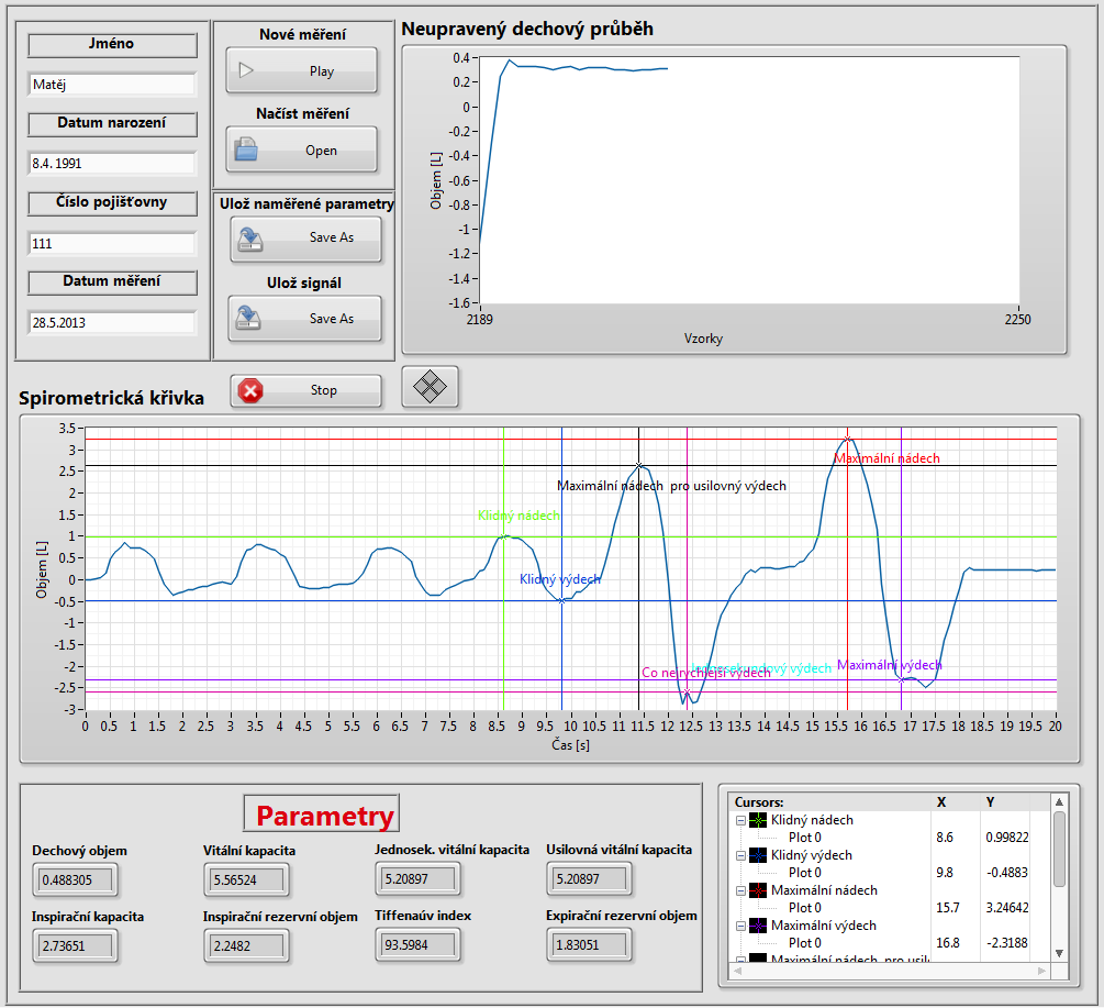 5 VYHODNOCOVÁNÍ VÝSLEDKŮ 5.1 Vzorové měření Pro zobrazení spirometrické křivky a správné hodnocení je nutno postupovat podle návodu do laboratorních cvičení na téma "Spirometrická měření" (Příloha 1.