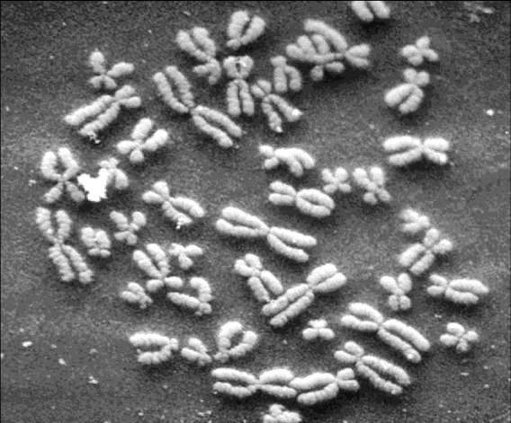eukaryontní chromozomy: - umístěny vždy v jádru eukaryontních buněk (tedy i lidských), které je od cytoplazmy oddělené membránou - jejich morfologie pozorovaná v mikroskopu závisí na tom, v jakém