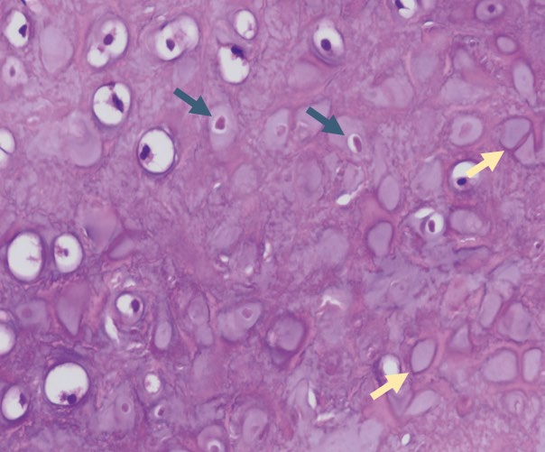 Sekce pregraduální teoretická část Obr. 3. Preparát transplantované chrupavky v barvení hematoxylin-eosinem.