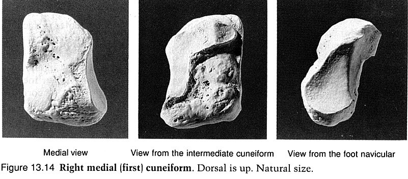 Os cuneiforme mediale kost klínovitá vnitřní Je největší, tvarem se podobá klínu, obrácenému ostřím do hřbetu nohy. Leží ve vnitřním oblouku nožní klenby a sousedí s os cuneiforme intermedium a 1.