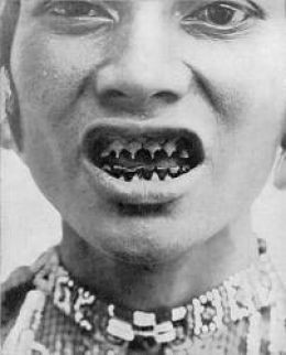 Typy mutilací
