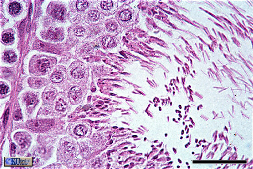 Seminiferous Tubule (rat) Two Sertoli cells (elongated cells with oval nuclei and prominent nucleoli) are attached to the basement membrane and stretch into the lumen of the tubule.
