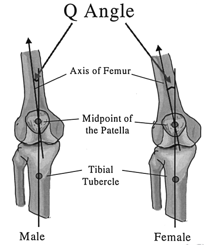 Anatomické a biomechanické parametry U žen je oproti mužům popisována větší anteverze krčku femuru a větší Q-úhel (quadriceps angle), neboli úhel valgozity (Mayer, Smékal, 2004).