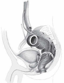 Anatomické poznámky 17 2.3 Chirurgická topografie malé pánve Znalost topografických vztahů rekta k okolním orgánům v malé pánvi je předpokladem přesné preparace při operaci (obr. 2.6).