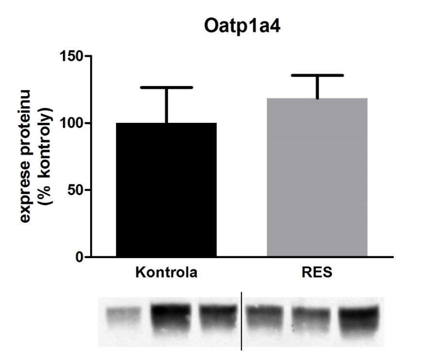 Obr. 11. Grafické znázornění výsledků Western blot analýzy Ntcp transportéru.