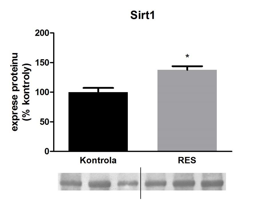 Obr. 13. Grafické znázornění výsledků Western blot analýzy Mrp3 transportéru.