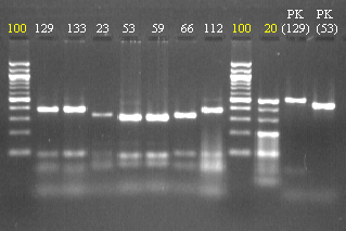 Příloha 2: Ukázky elektroforeogramů získaných po digesci PCR produktu restrikčními endonukleázami.