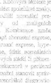 prgnózu (4). Predikce rizika Přítmnst jedntlivých mlekul na blastech ALL je in tenzivně zkumána z phledu ptenciálních predjktrů úspěšnsti terapie.