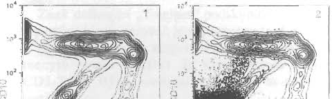 E. Me j stříkv,.-.-:s::tra:.:n:.:a=---=1..:: 6.:... 7?l ALL" (11-14). B lymfcyty v periferní krvi tent znak nemají, na rzdíl d většiny B-prekurzrů v kstní dřeni.
