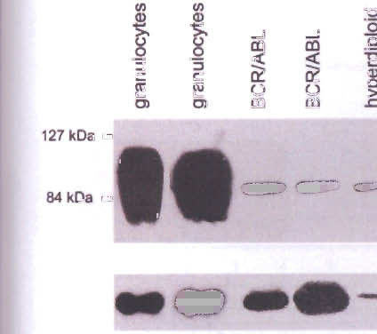 >. >. >. Cl Ol aj c UJ a::: Cf) a::: <: z --- - - - (3-actin Figure 5 Western bit f granulcytes, ALL samples f CD66c psitive cases and surface CD66c ne g cell lines with TEUAMLI ps (REH), MLUAF4ps