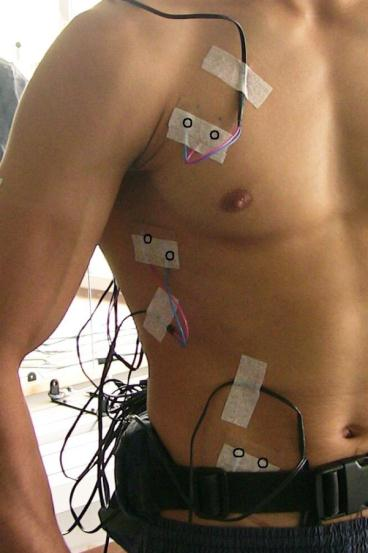 Lokalizaci elektrod na svaly m. pectoralis major, m. serratus anterior a m. obliquus abdominis externus zobrazuje obr. č. 7. Obr. č. 8 zobrazuje lokalizaci elektrod na svaly m. latissimus dorsi, m.