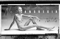 Příloha 3 O šokujícím účinku tohoto billboardu nemůže být pochyb. Je součástí kampaně Ne anorexii, která tvrdí, že svět módy produkuje extrémně štíhlé modelky.