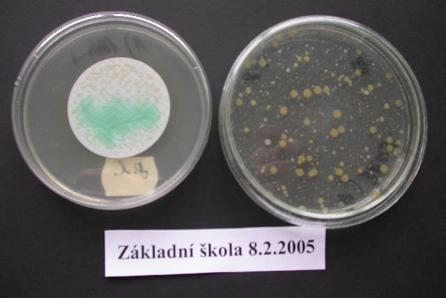 Ps. aeruginosa počet
