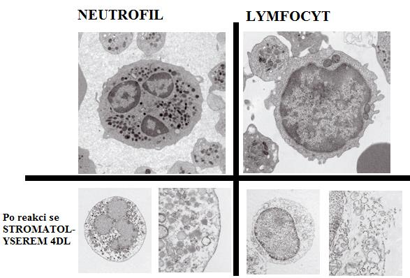 3 Experimentální část Obrázek č. 9 : Buňky po působení Stromatolyseru-4DL snímány transmisním elektronovým mikroskopem [Převzato a upraveno dle 26, s.