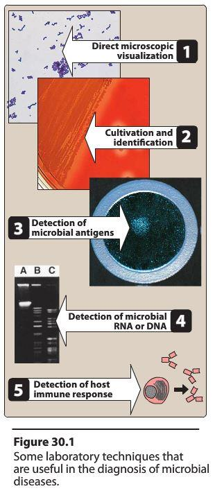 identifikace mikroorganizmu zásadní pro výběr ATB mikroskopie kultivace a identifikace zajištění biologického materiálu PŘED