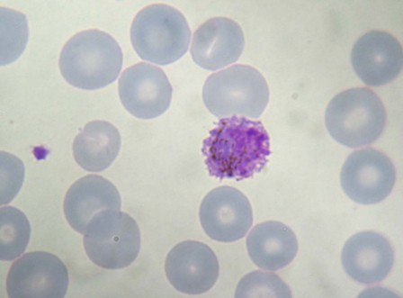 Obrázek 2: Plasmodium ovale (zralý samčí gametocyt) Zdroj: Převzato z (Bashir, 2002-2016) 4.3 Plasmodium malariae Jedná se o původce tzv. kvartány (čtyřdenní malárie).