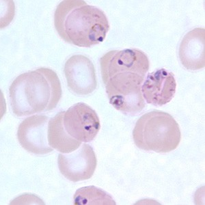 jako schizonty či starší trofozoity, mají často pozměněný povrch a mohou se zachytávat na stěnách cév v určitých tkáních (plíce, játra). Tvar erytrocytů bývá normální.
