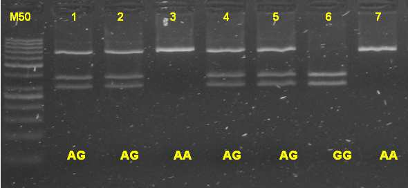 Tab.2 Frekvence genotypů MbiI PCR-RFL Serpine genotyp absolutní četnost relativní četnost AA 43 0,44 AB 43 0,44 BB 12 0,12 Obr.