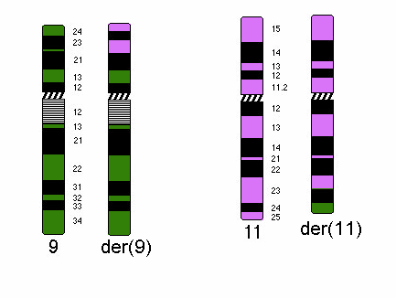 chromozomy 9 a 11 a v jedné mitóze trizomii chromozomu 8. FISH potvrdila přestavbu MLL genu v 65% interfázních jader a trizomii chromozomu 8 v 76% interfázních jader.