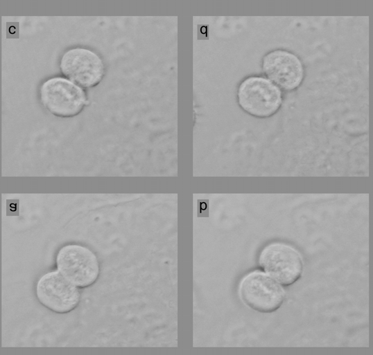 Cell cycle checkpoints (kontrolní body buň. cyklu) Checkpoints umožňují zpomalit nebo zastavit buněčný cyklus při poškození DNA, neúplné replikaci nebo chybě při sestavování mitotických chromosomů.