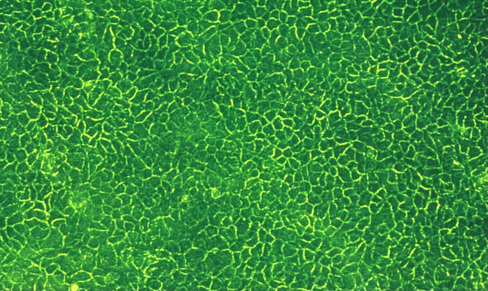 Cultured keratinocyte grafting Absorbance (%) 800 700 600 500 400 300 200 100 0 BSA PBS Man-BSA Hep Fuc-BSA 24 H 72 H 144 H Time (Hours) Growth of human keratinocytes on polystyrene with preadsorbed