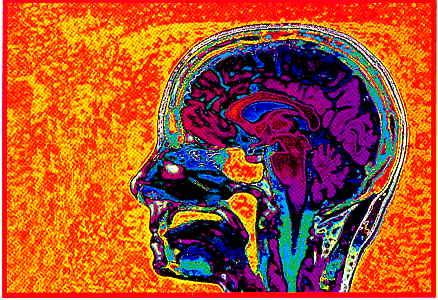 Zobrazování magnetickou rezonancí Magnetic Resonance Imaging MRI Využití 1 H NMR spektroskopie v lékařství (NMR tomografie) Metoda je založená na měření rozdílných spin-mřížkových