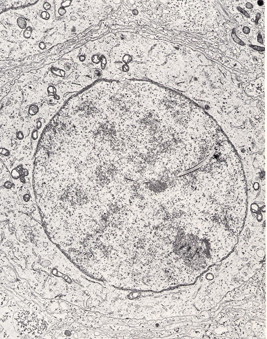 Primární spermatocyt a synaptonemální komplex Primární spermatocyt vstupuje do