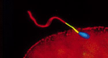 Spermatozoon Hlavička (nucleus a akrosom) Bičík flagellum Krček spojovací část