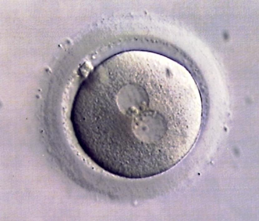 Fertilizace Splynutí se spermií vyvolá dokončení meiosy sekundární pólové tělísko a definitivní zralý oocyt Fertilizovaný oocyt = zygota Do vajíčka pronikne obsah spermie