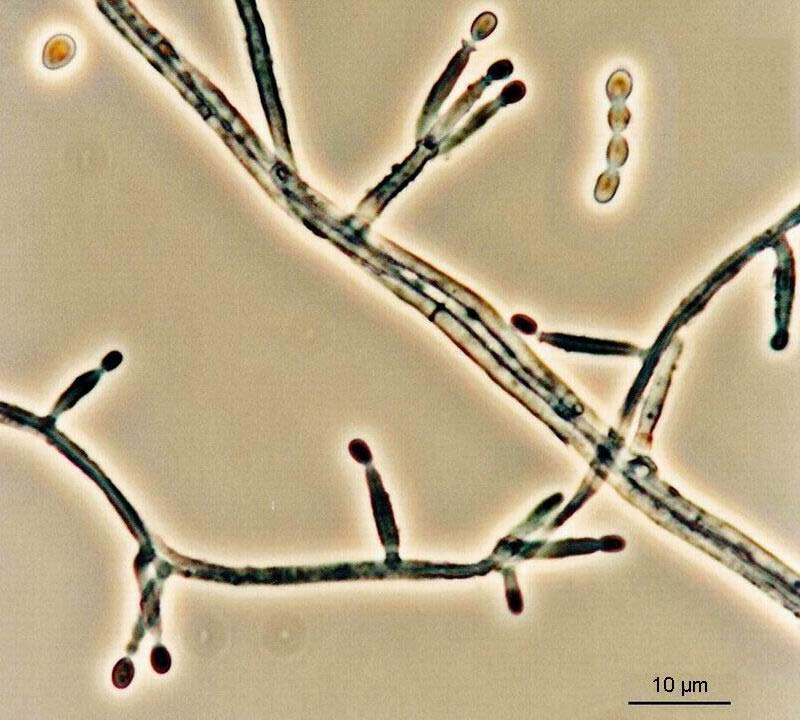 Geosmithia fassatiae mikroznaky, AK