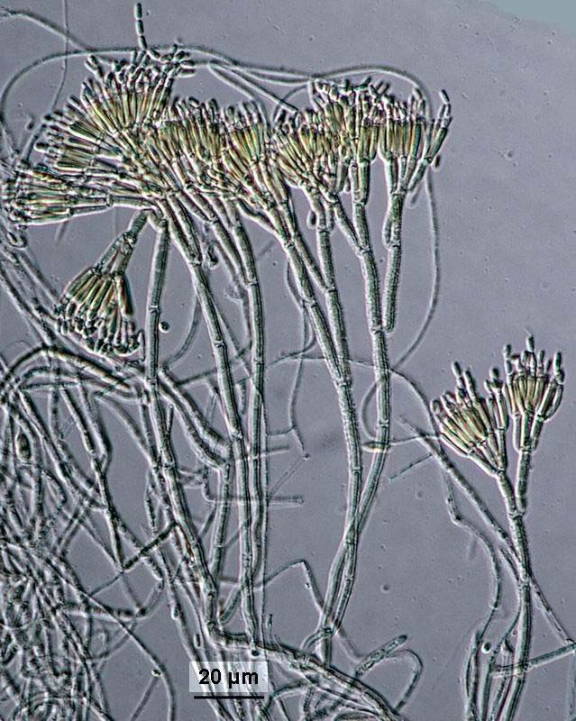 Geosmithia lavendula mikroznaky, CCF 3398