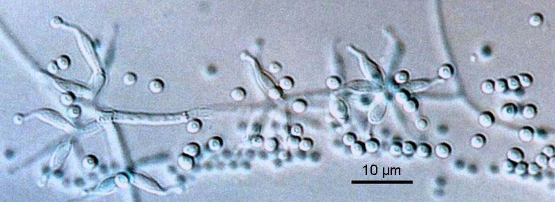 Tolypocladium