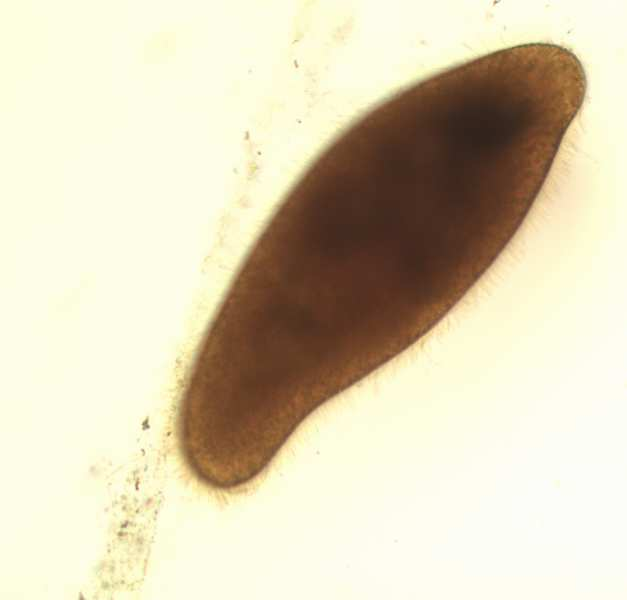 Obrázek 26: Trepka velká (Paramecium caudatum) - Lugolův