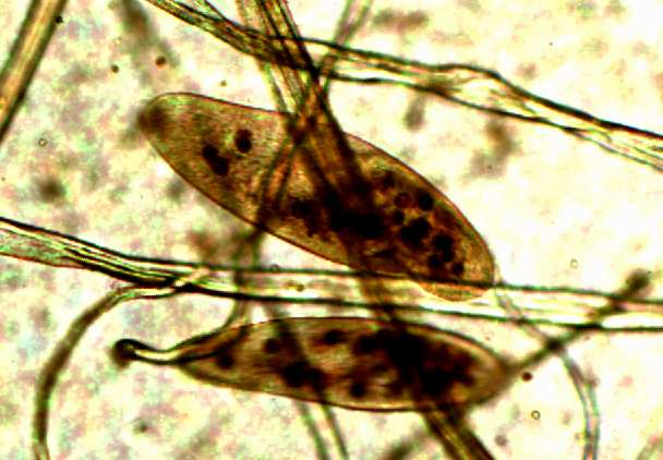 Obrázek 31: Trepka velká (Paramecium caudatum) naplněné potravní vakuoly barvenými