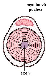 Dva typy postižen ení periferních nervů axonáln lní degenerace - poškození axonu a