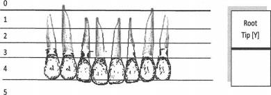 Hrot korunky špičáku je v oblasti korunky řezáku. 2. Hrot korunky špičáku leží v horizontální rovině cervikální třetiny kořene řezáku. 3.