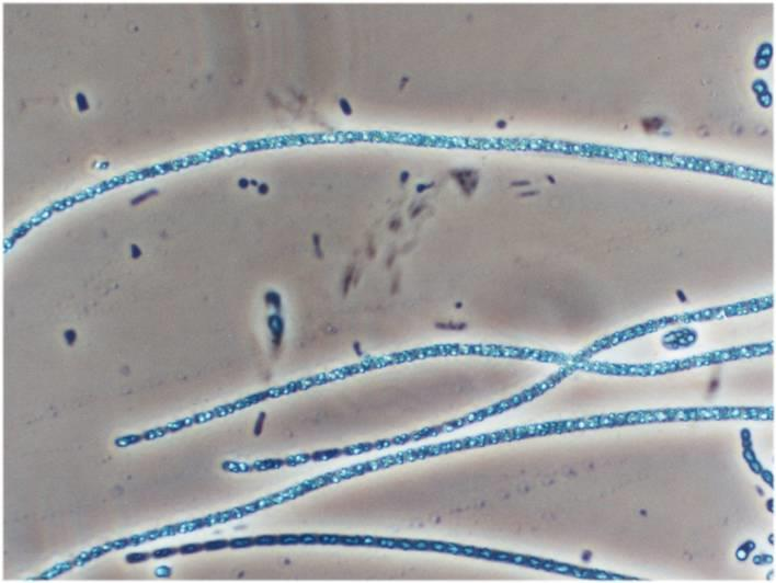 Thiothrix spp.