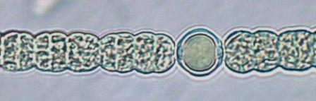 Tlustostěnné buňky, fixace vzdušného dusíku - Vznik z vegetativních buněk při dusíkovém