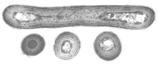Sinice stavba buňky Thylakoidy - Ploché váčky s fotosyntetickým aparátem